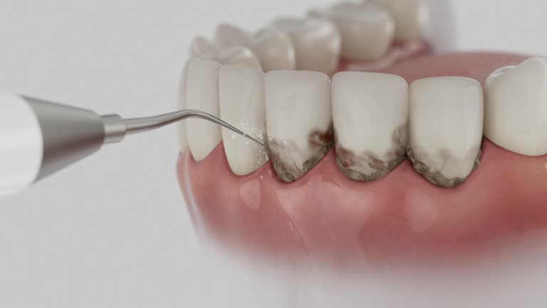 Trusted Dental Crowns And Bridges service in Clare, MI - Dentist Open Now